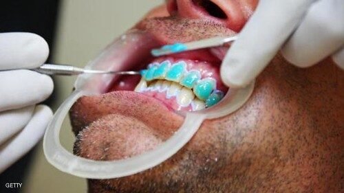 How Much Does It Cost To Remove Wisdom Teeth