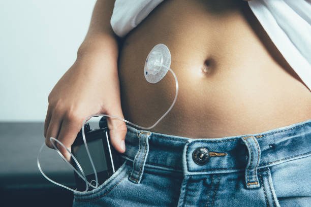 Insulin Pump cost